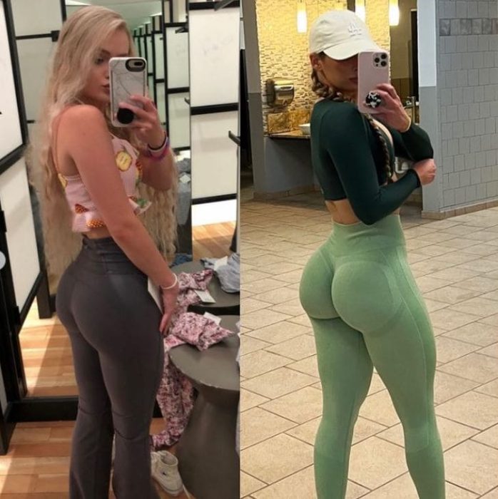 Bailey Stewart Age, Boyfriend, Surgery, Height, Wiki, Bio, Net Worth