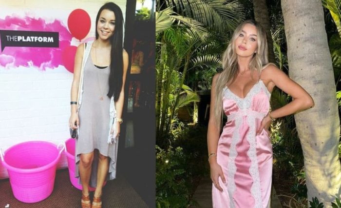 Sierra Furtado Before and After