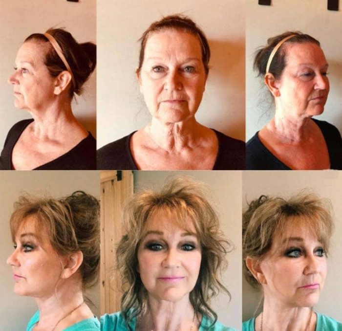 Kat Wonders Age, Boyfriend, Surgery, Nationality, Wiki, Bio, Net Worth