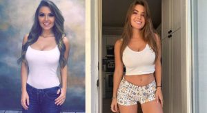 Sofia Bevarly Before and After